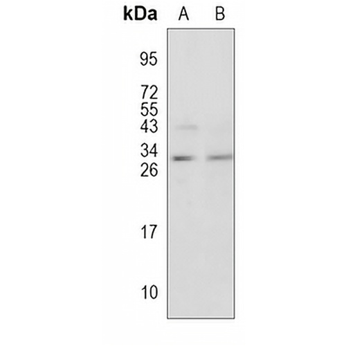 RGS19 Rabbit Polyclonal Antibody