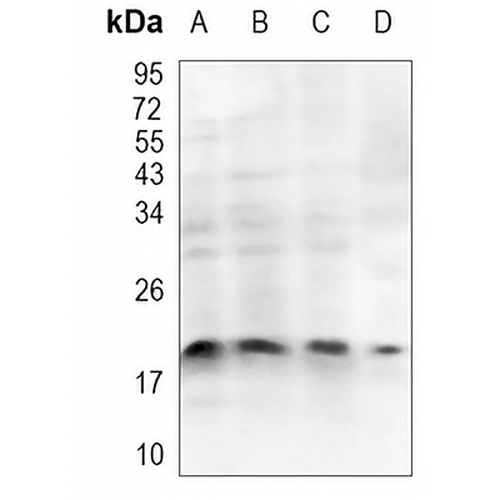 Claudin 5 Rabbit Polyclonal Antibody