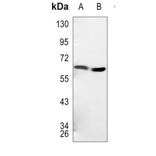 TBC1D3 Rabbit Polyclonal Antibody