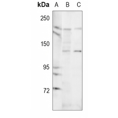 MRCK beta Rabbit Polyclonal Antibody