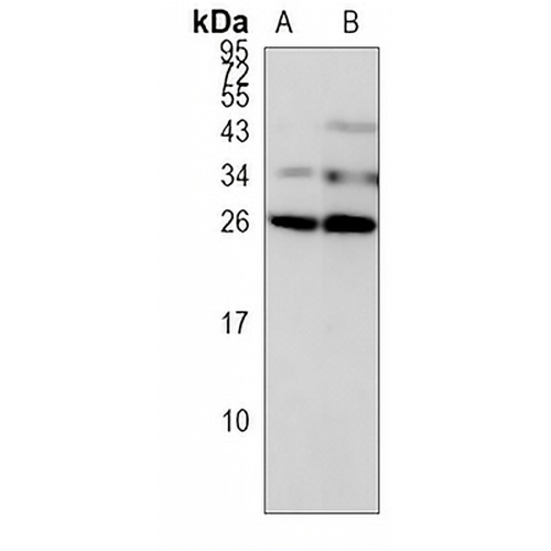 CIDEC Rabbit Polyclonal Antibody