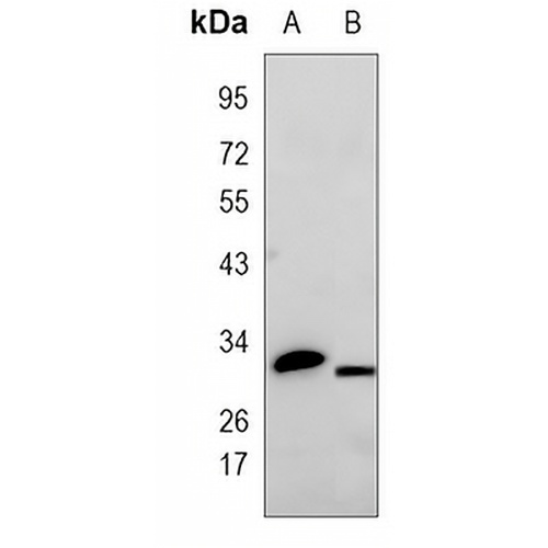 Calretinin Rabbit Polyclonal Antibody