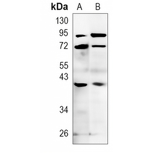 CD158f2 Rabbit Polyclonal Antibody
