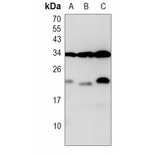 JTB Rabbit Polyclonal Antibody