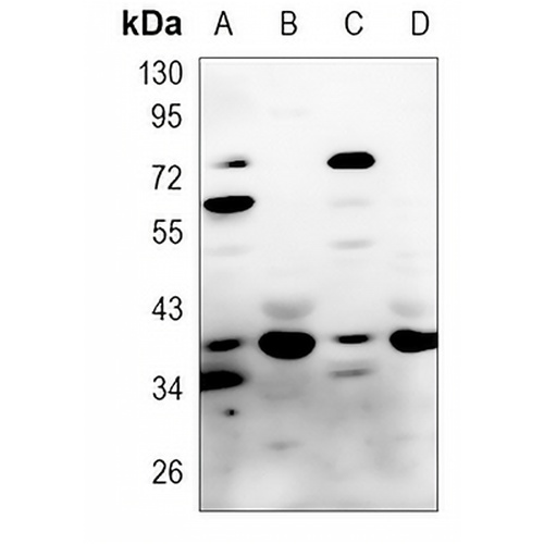 HSPA6/7 Rabbit Polyclonal Antibody