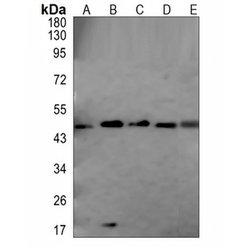 TRIB3 Rabbit Polyclonal Antibody