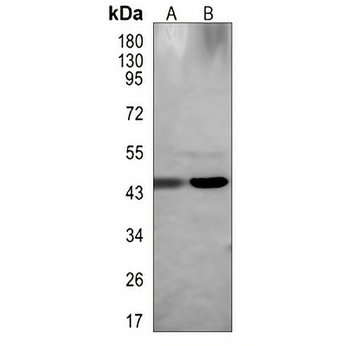 TSSK1B Rabbit Polyclonal Antibody