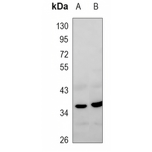 SFRP1 Rabbit Polyclonal Antibody