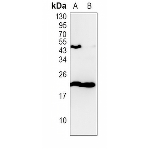 FDCSP Rabbit Polyclonal Antibody