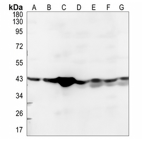 EDG4 Rabbit Polyclonal Antibody