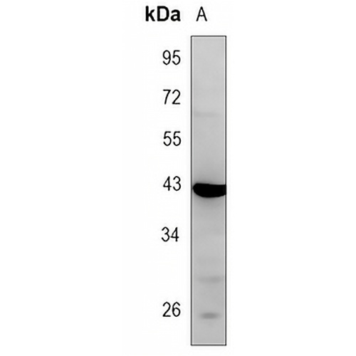 GPR100 Rabbit Polyclonal Antibody