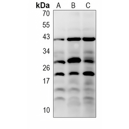 MYL2 (Phospho-S15) Rabbit Polyclonal Antibody