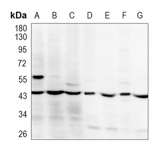 PGK1/2 Rabbit Polyclonal Antibody