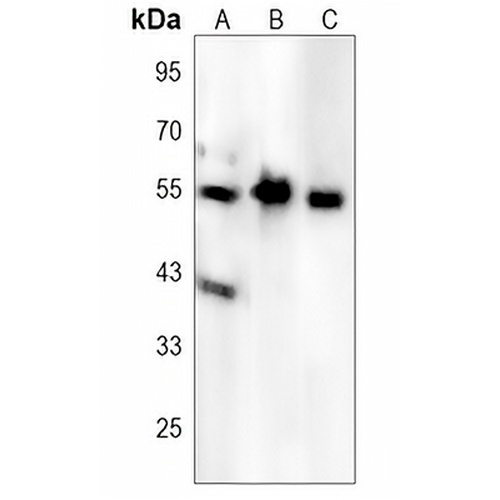 MLKL (Phospho-S125) Rabbit Polyclonal Antibody