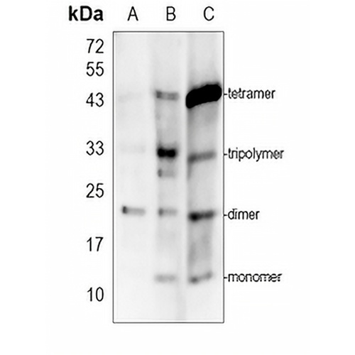 Substance P Rabbit Polyclonal Antibody