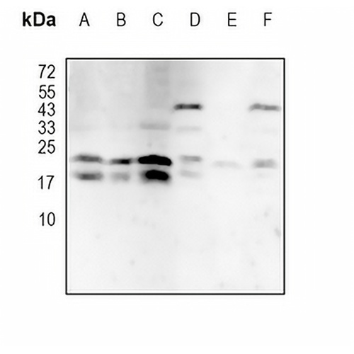 PIN1 (Acetyl-K46) Rabbit Polyclonal Antibody