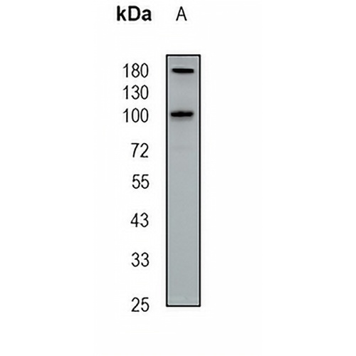NSUN2 Rabbit Polyclonal Antibody
