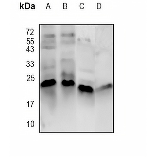 BIK Rabbit Polyclonal Antibody