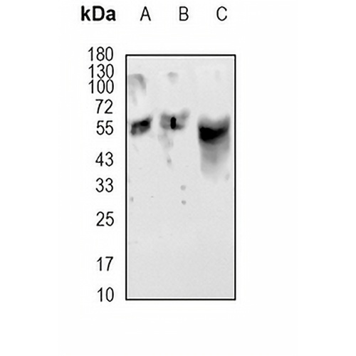 ROR gamma T Rabbit Polyclonal Antibody