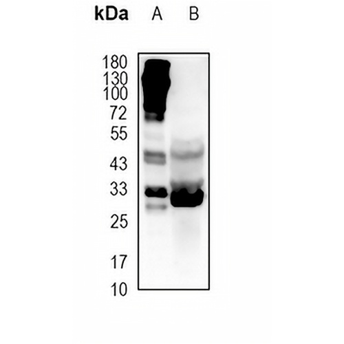 SRD5A1 Rabbit Polyclonal Antibody