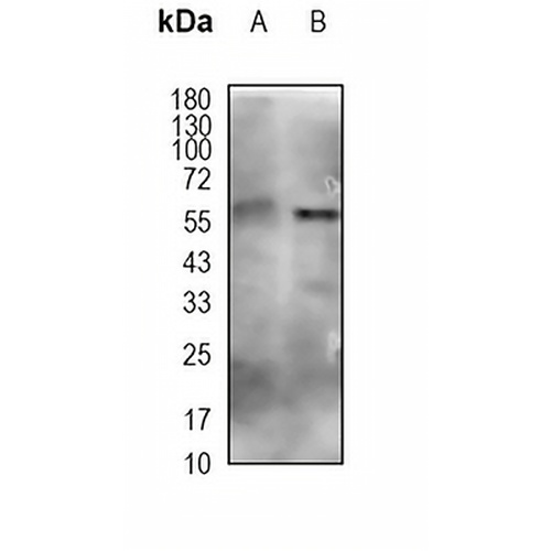 Pyruvate Kinase (Phospho-S37) Rabbit Polyclonal Antibody