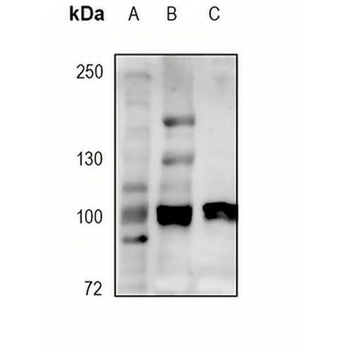 EPHA2 (Phospho-S901) Rabbit Polyclonal Antibody