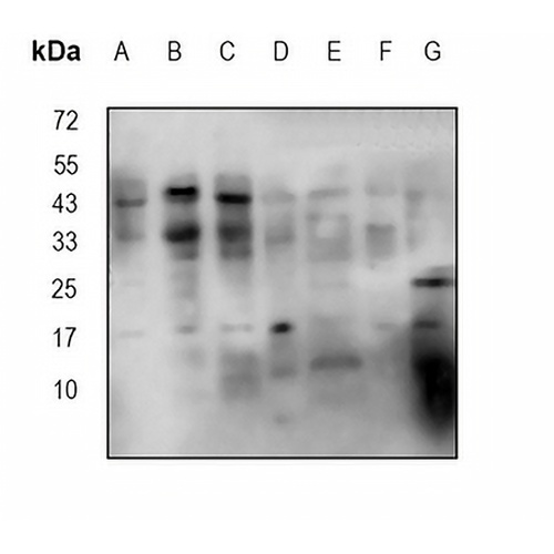 FDX1 (Phospho-S159) Rabbit Polyclonal Antibody