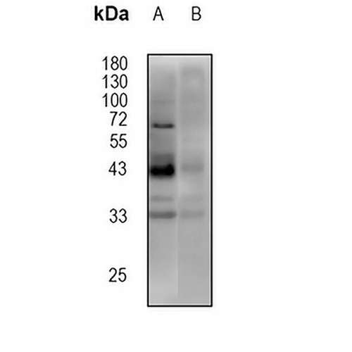 PARVA (Phospho-S14) Rabbit Polyclonal Antibody