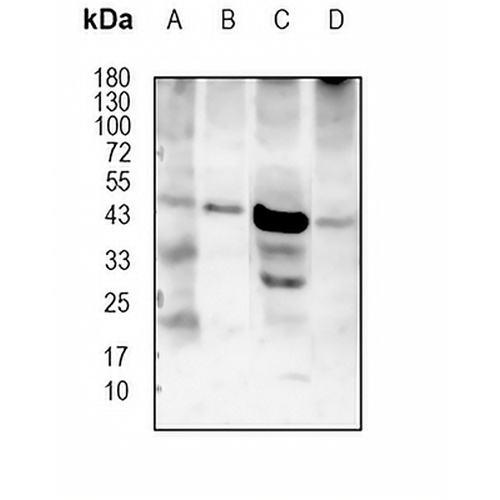 Adipophilin (Phospho-S159) Rabbit Polyclonal Antibody