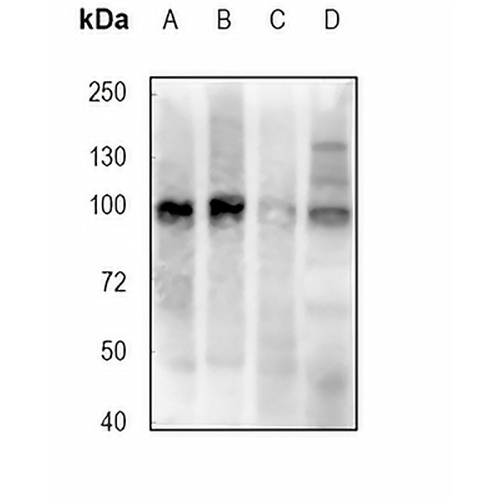 EZH2 (Phospho-T487) Rabbit Polyclonal Antibody