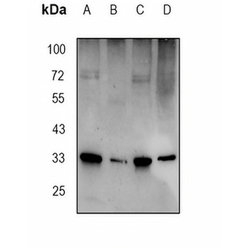 LIMK1 (Phospho-S323) Rabbit Polyclonal Antibody