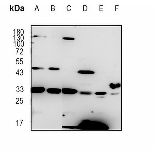 CDK5 Rabbit Polyclonal Antibody
