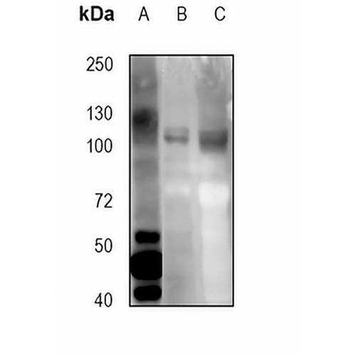 EPHA2 Rabbit Polyclonal Antibody