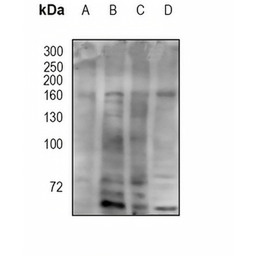 IRS4 Rabbit Polyclonal Antibody