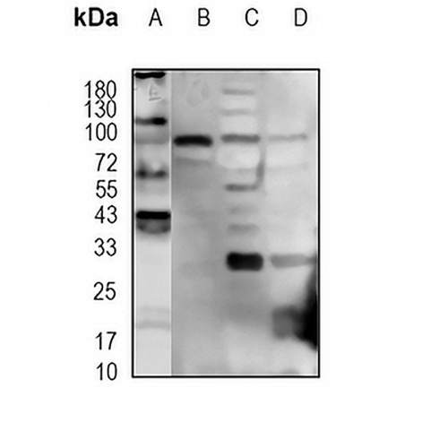 FOXO3 Rabbit Polyclonal Antibody