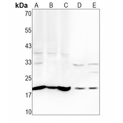 REG3G Rabbit Polyclonal Antibody