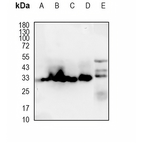 KHK Isoform C Rabbit Polyclonal Antibody