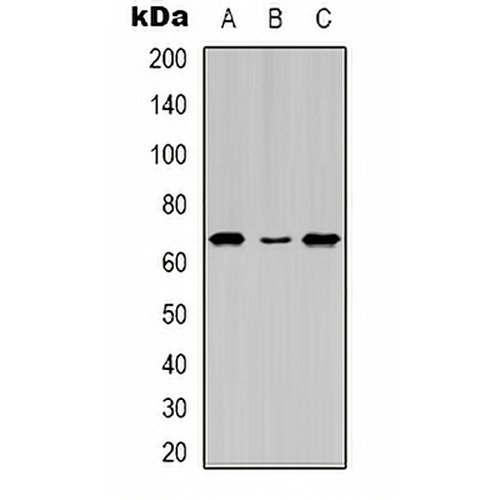 Estrogen Receptor alpha (Phospho-S104) Rabbit Polyclonal Antibody