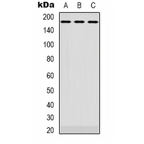 EGFR Rabbit Polyclonal Antibody