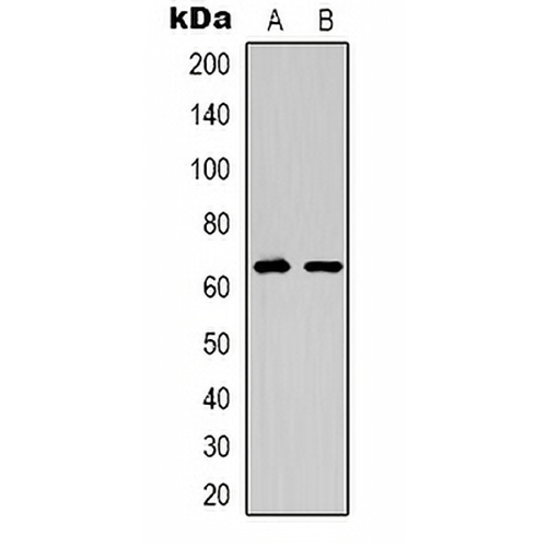 EPO Receptor Rabbit Polyclonal Antibody