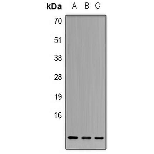 Cystatin A Rabbit Polyclonal Antibody