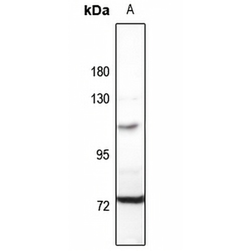 MID1 Rabbit Polyclonal Antibody