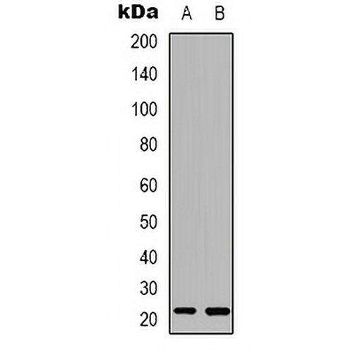 RAB37 Rabbit Polyclonal Antibody