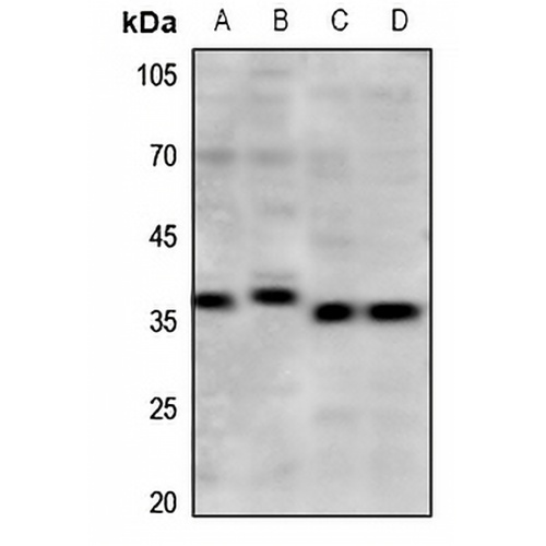 mPR gamma Rabbit Polyclonal Antibody