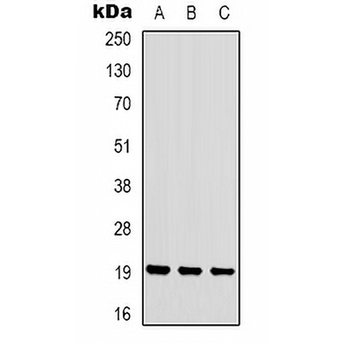 STMN1 (Phospho-S16) Rabbit Polyclonal Antibody
