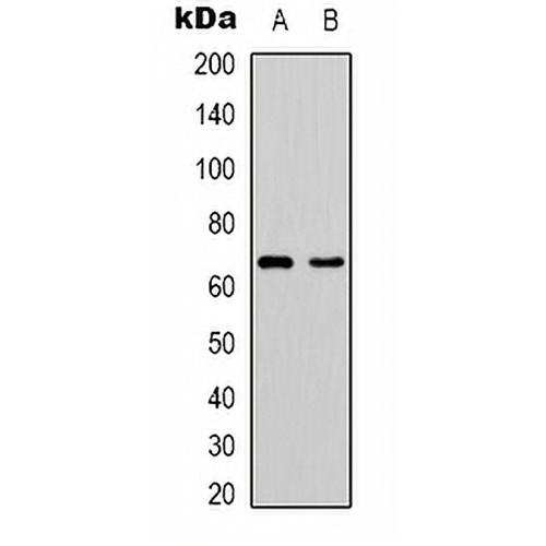 PAK1 Rabbit Polyclonal Antibody
