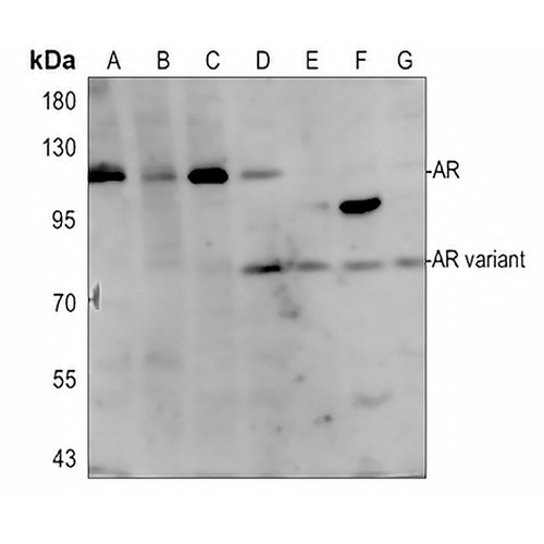 Androgen Receptor Rabbit Polyclonal Antibody