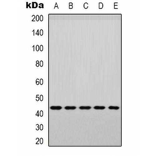 p38 (Phospho-Y182) Rabbit Polyclonal Antibody