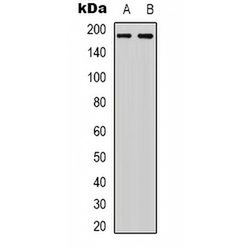 HER2 Rabbit Polyclonal Antibody