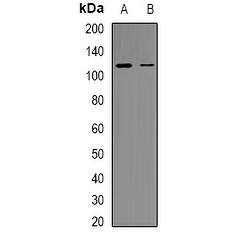 RB1 (Phospho-S807) Rabbit Polyclonal Antibody